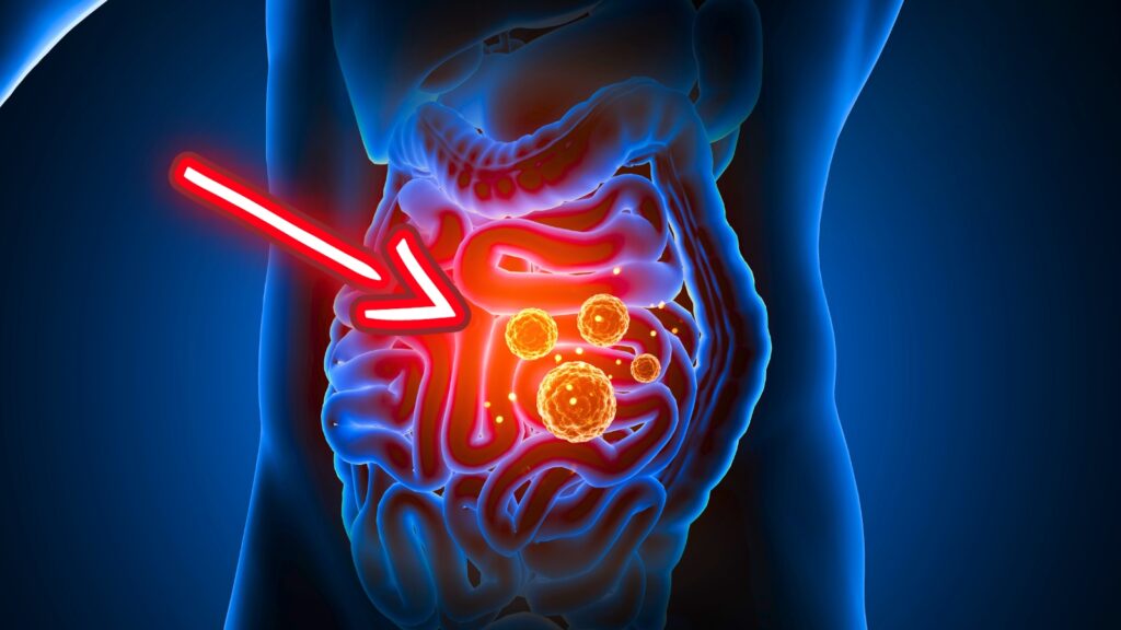 Is your gut health at risk? Warning signs and solutions!